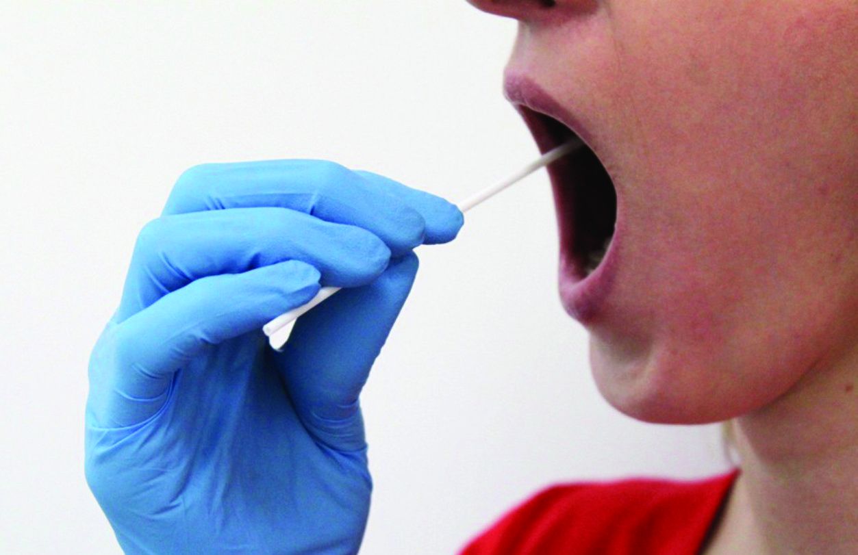 Collecting buccal swabs samples using cotton swabs