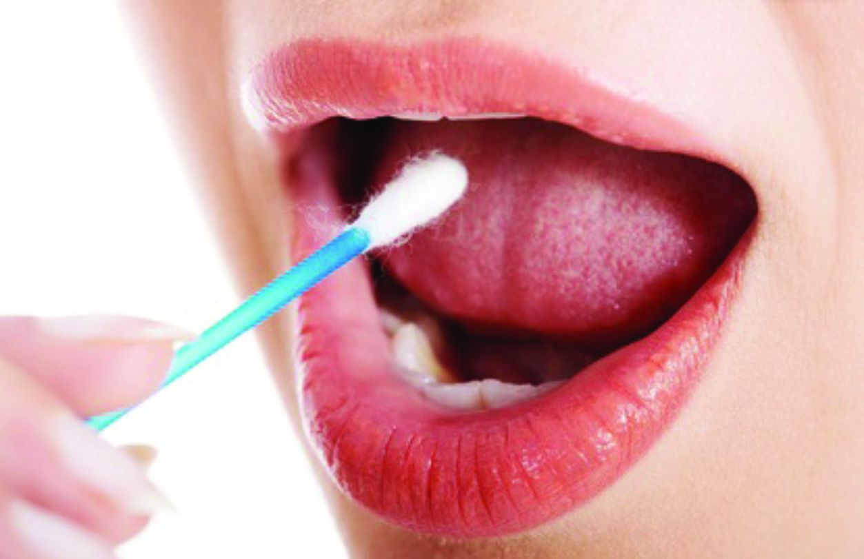 Collecting buccal swabs samples using cotton tips